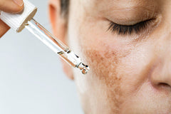 Your Ultimate Guide to Managing Melasma with ZO Skin Health Products
